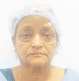 patient Image